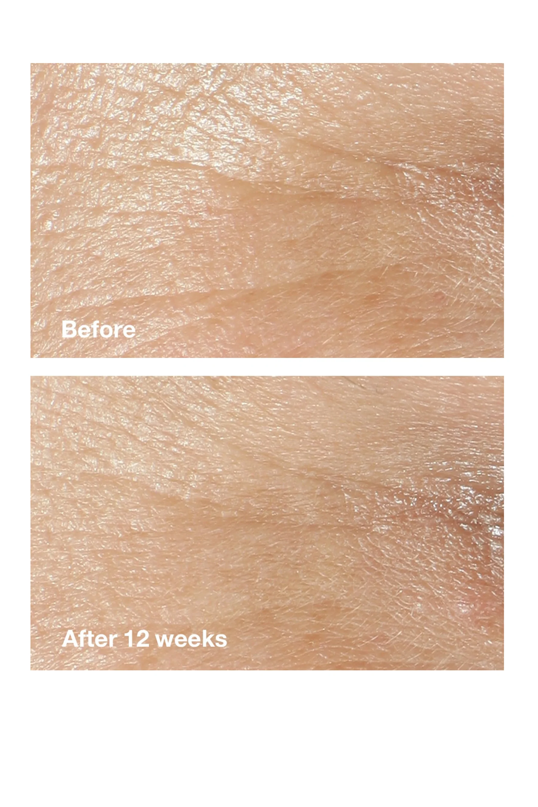 CLINIQUE Smart Clinical Repair Wrinkle Correcting Cream 50ml - All Skin Types - Image 2