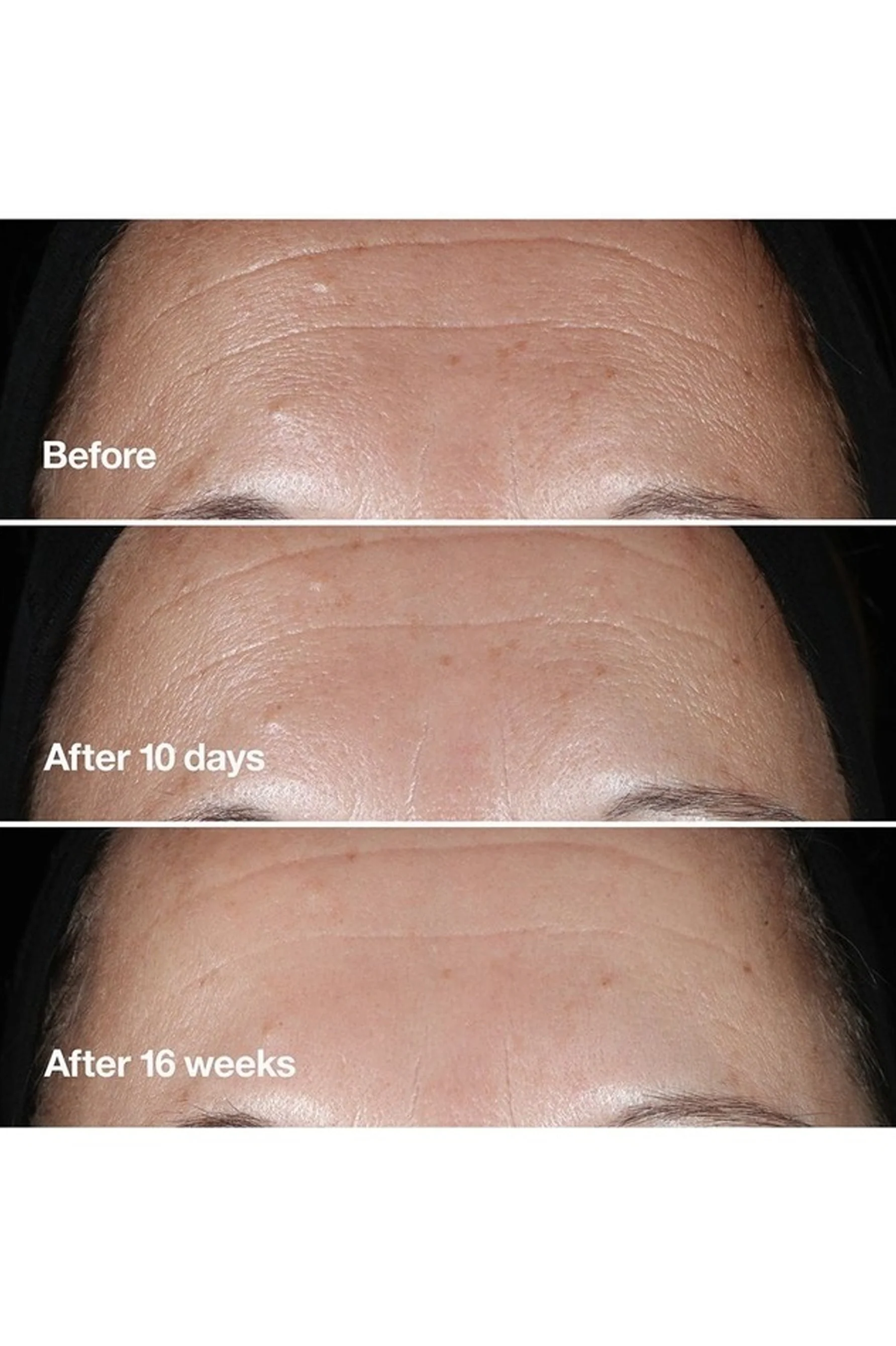 CLINIQUE Smart Clinical Repair Correction Serum 50ml - Image 3