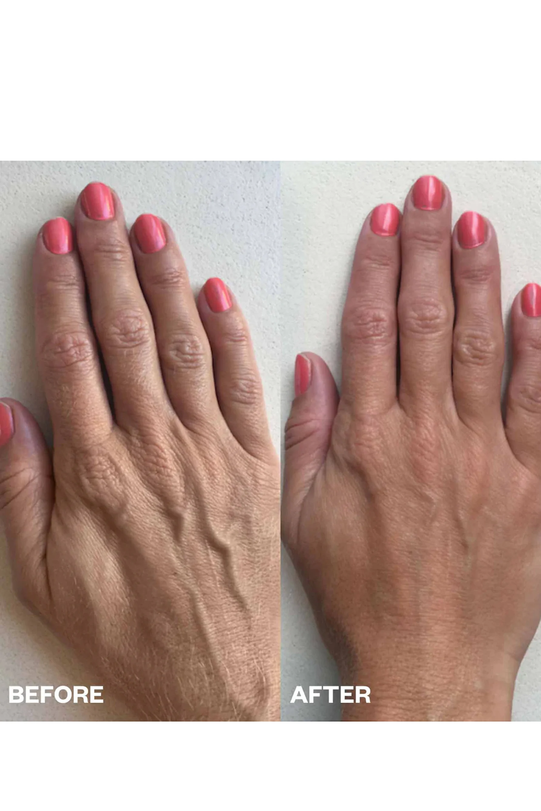 WRINKLES SCHMINKLES  Smoothing Kit Hand - Image 2